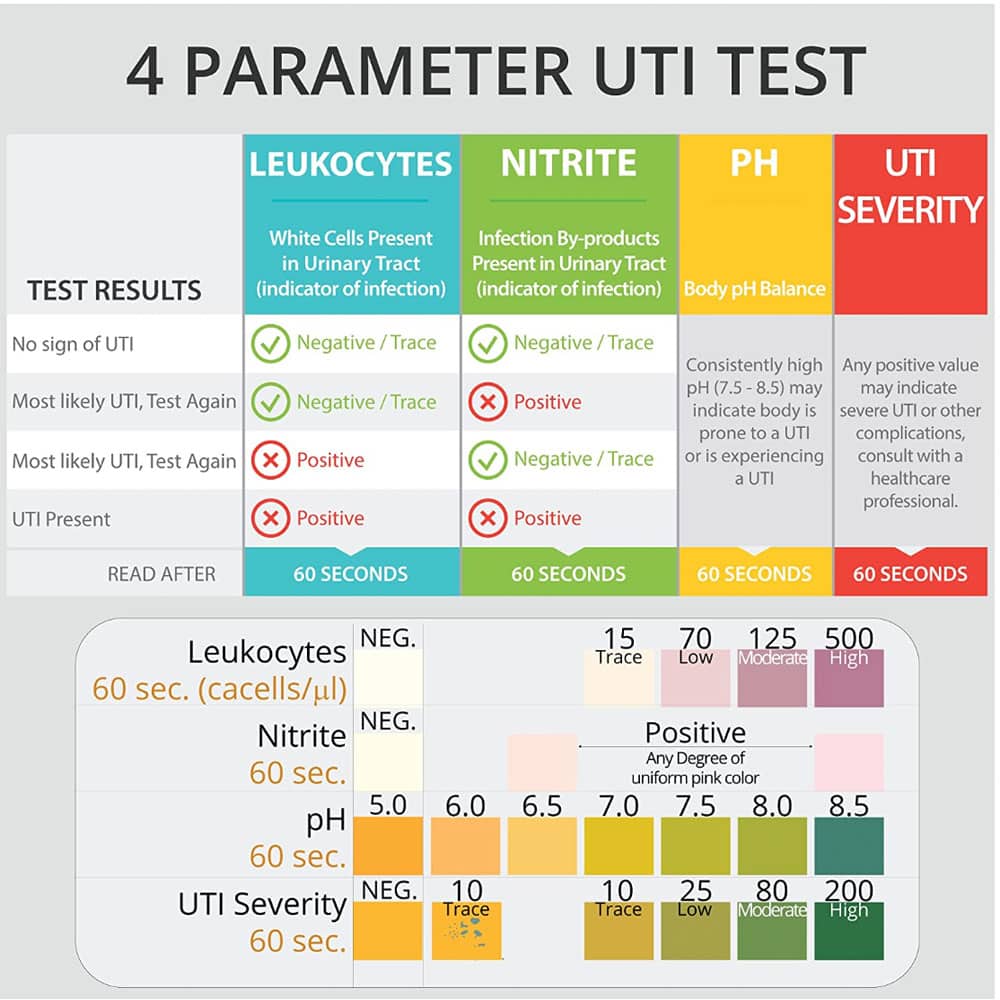 Sample Urinalysis Uti